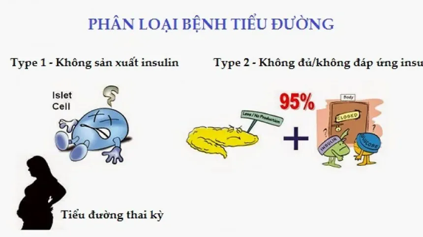 Tất tần tật về 3 loại tiểu đường: Type 1, Type 2 và tiểu đường thai kỳ