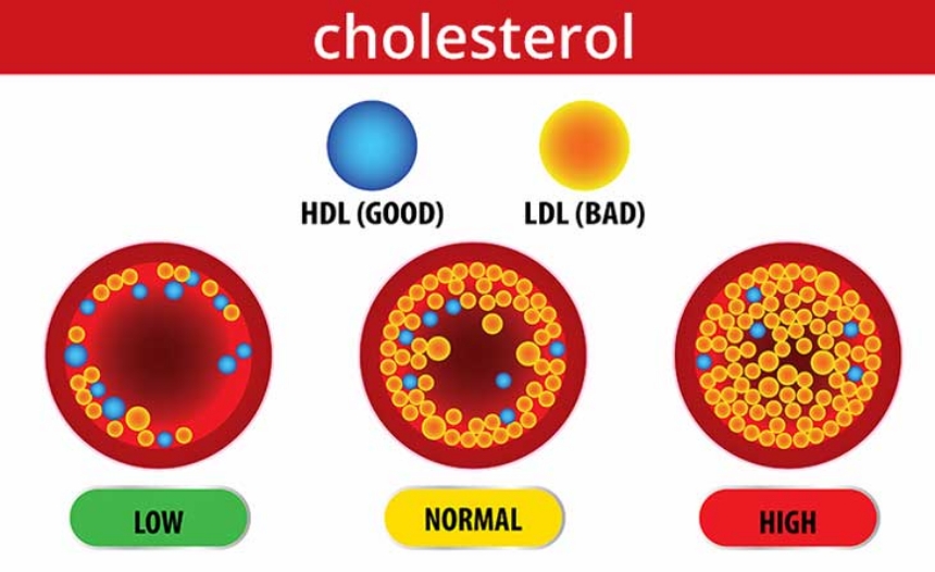 Cholesterol Cao: Nguyên Nhân, Tác Hại và Cách Kiểm Soát Hiệu Quả