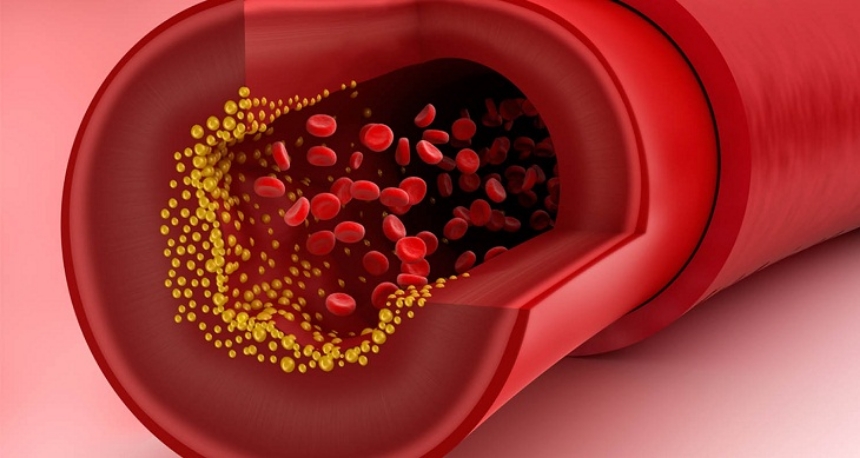 Biết định nghĩa về tỷ lệ Cholesterol và ý nghĩa của nó là gì tại sao quan trọng?