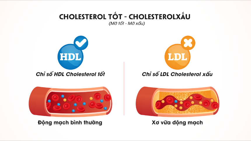 HDL và LDL Cholesterol là gì? Sự khác biệt giữa HDL và LDL Cholesterol?