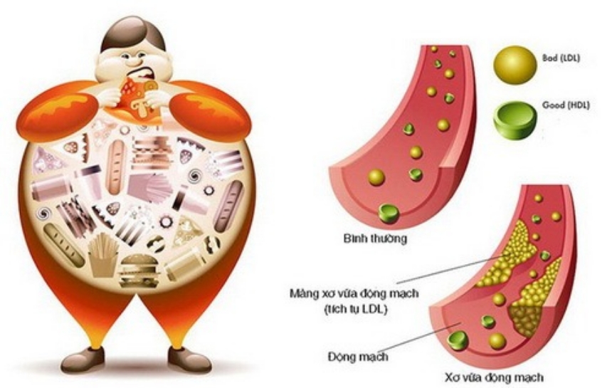 Cách theo dõi và kiểm tra mức độ mỡ máu thường xuyên tại nhà