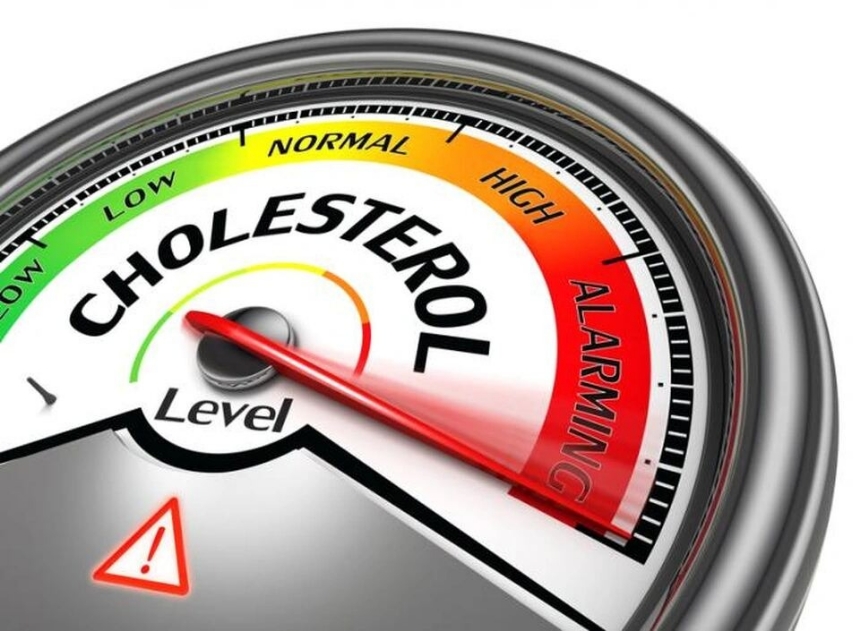 Lượng cholesterol khuyến nghị hàng ngày để có sức khỏe tốt là bao nhiêu?