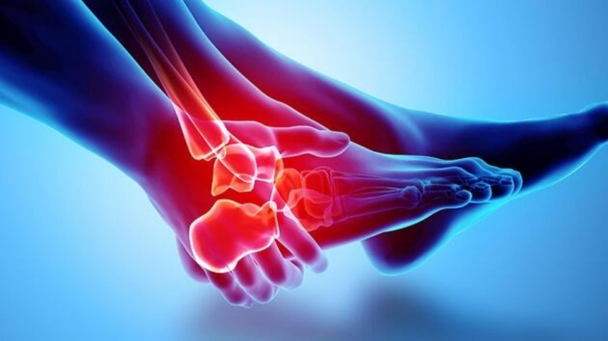 Bệnh gout có di truyền không? Những điều cần biết.