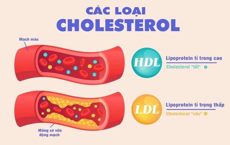 cac-loai-cholesterol-ldl-va-hdl