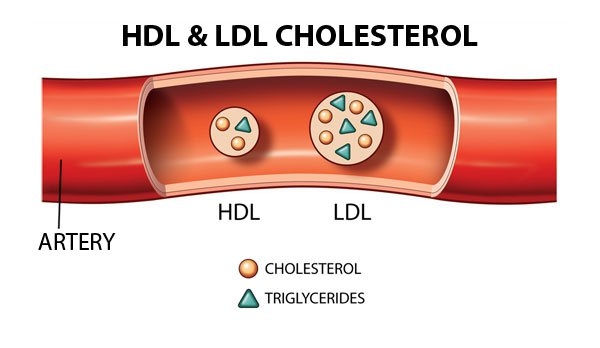 HDL và LDL Cholesterol