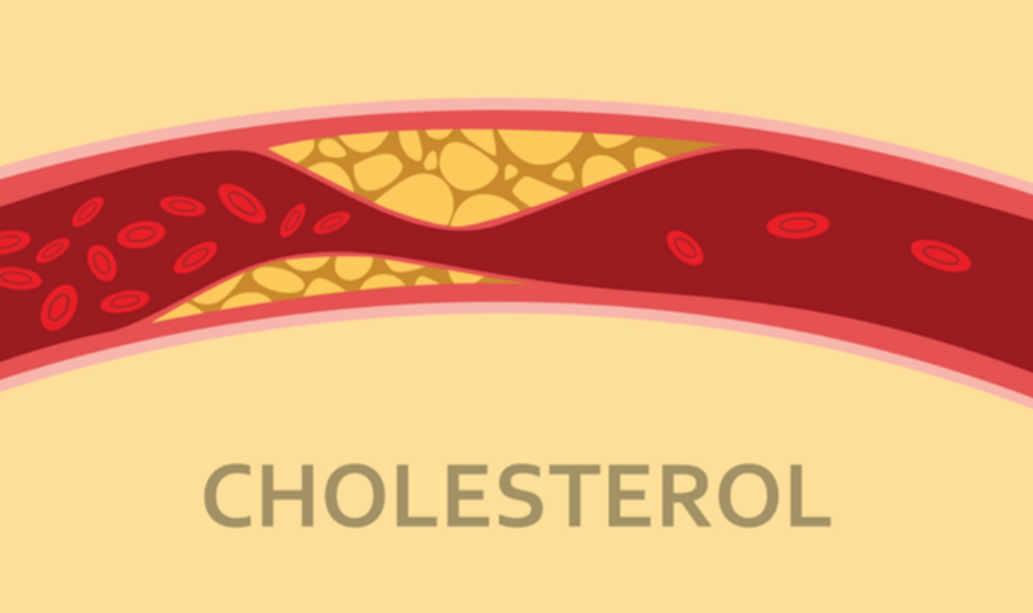 moi-quan-he-giua-cholesterol-va-pizza