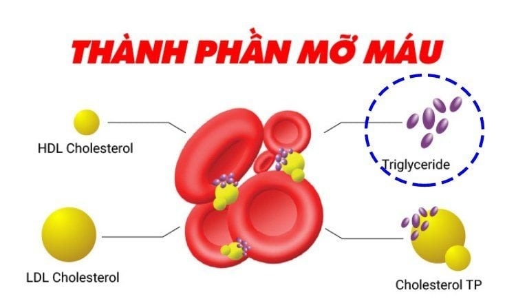 tang-cholesterol-va-triglyceride-mo-mau-trong-thai-ky