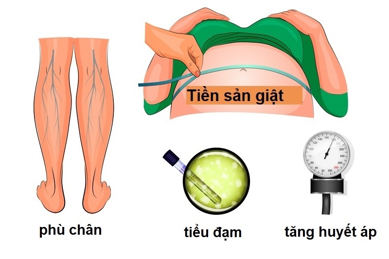 tien-san-giat-trong-thoi-gian-thai-ky